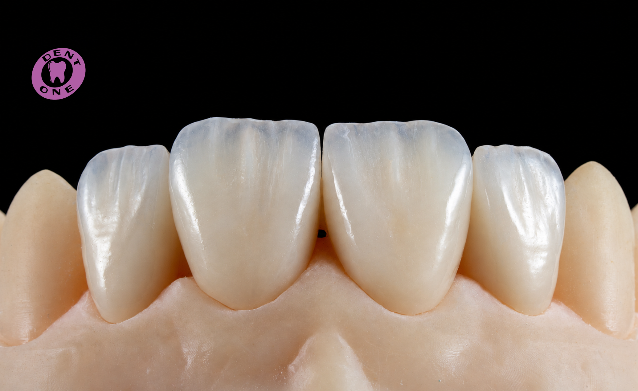Dettaglio estetico DentOne
